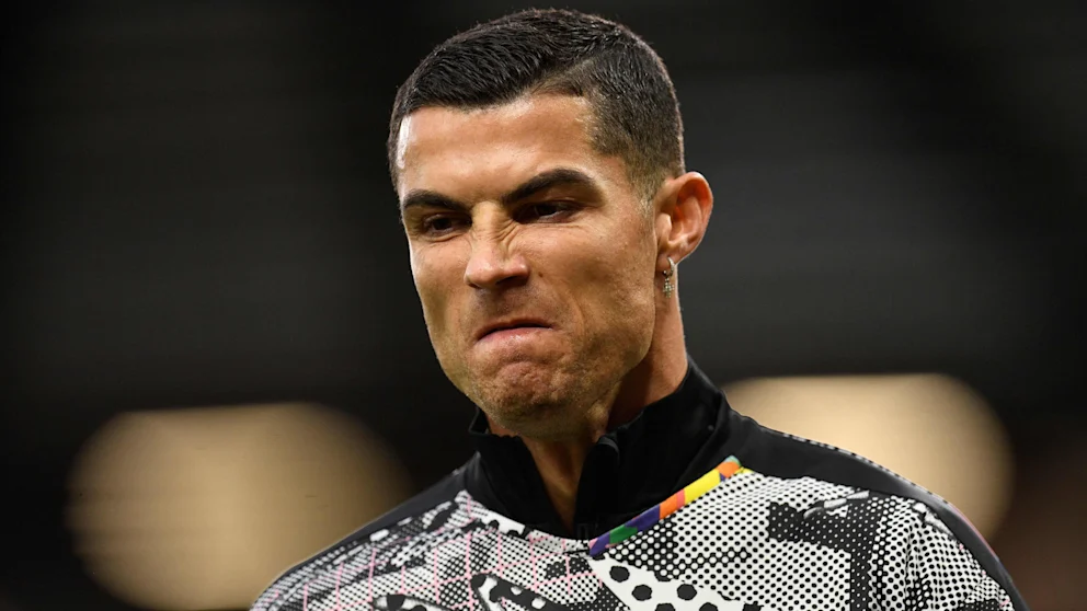 Ronaldo’nun başı botoksu yüzünden dertte